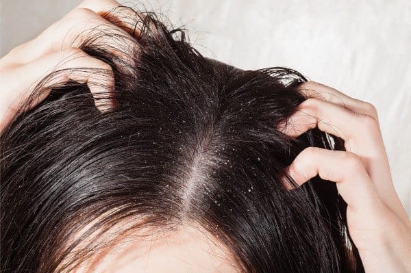 Hair & Scalp Problems - Mona Dermatology