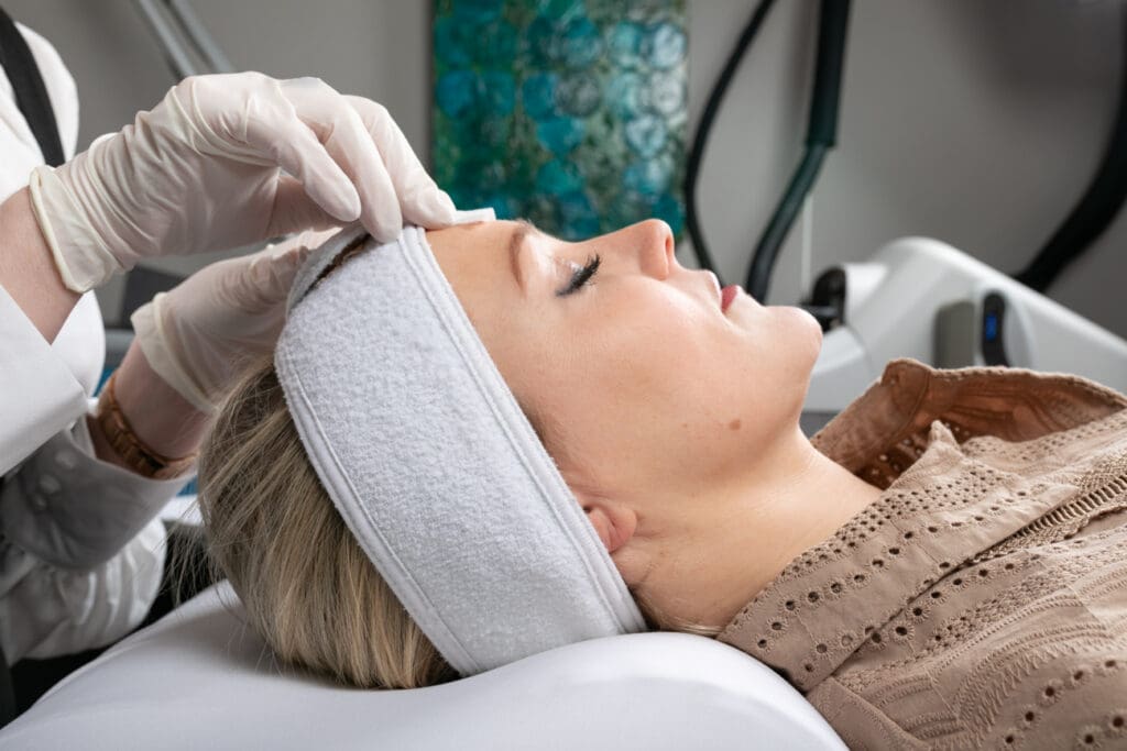 Procedure. Facial peel. Chemical peel Benefits. Patient. Mona Dermatology Cincinnati.